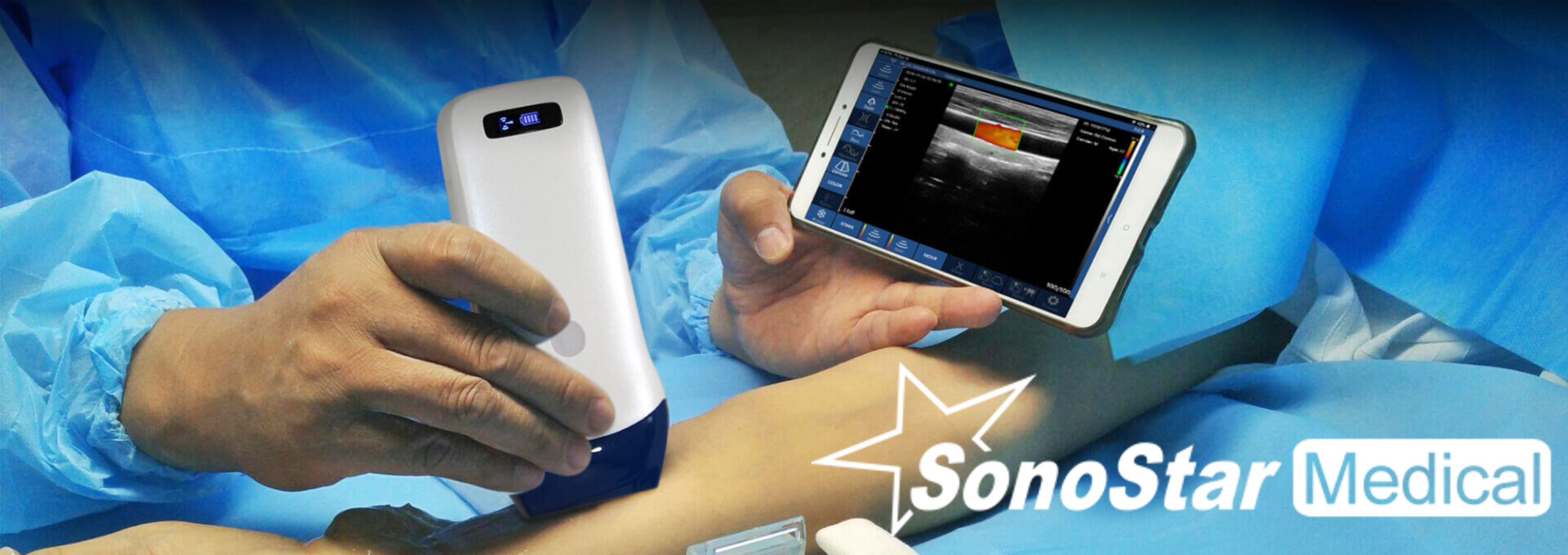 sonostar canada