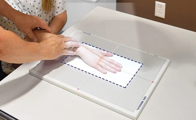 OTC18M Auto-Collimation