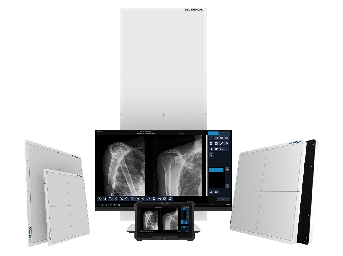 DELWORKS Pre-Exposure Display