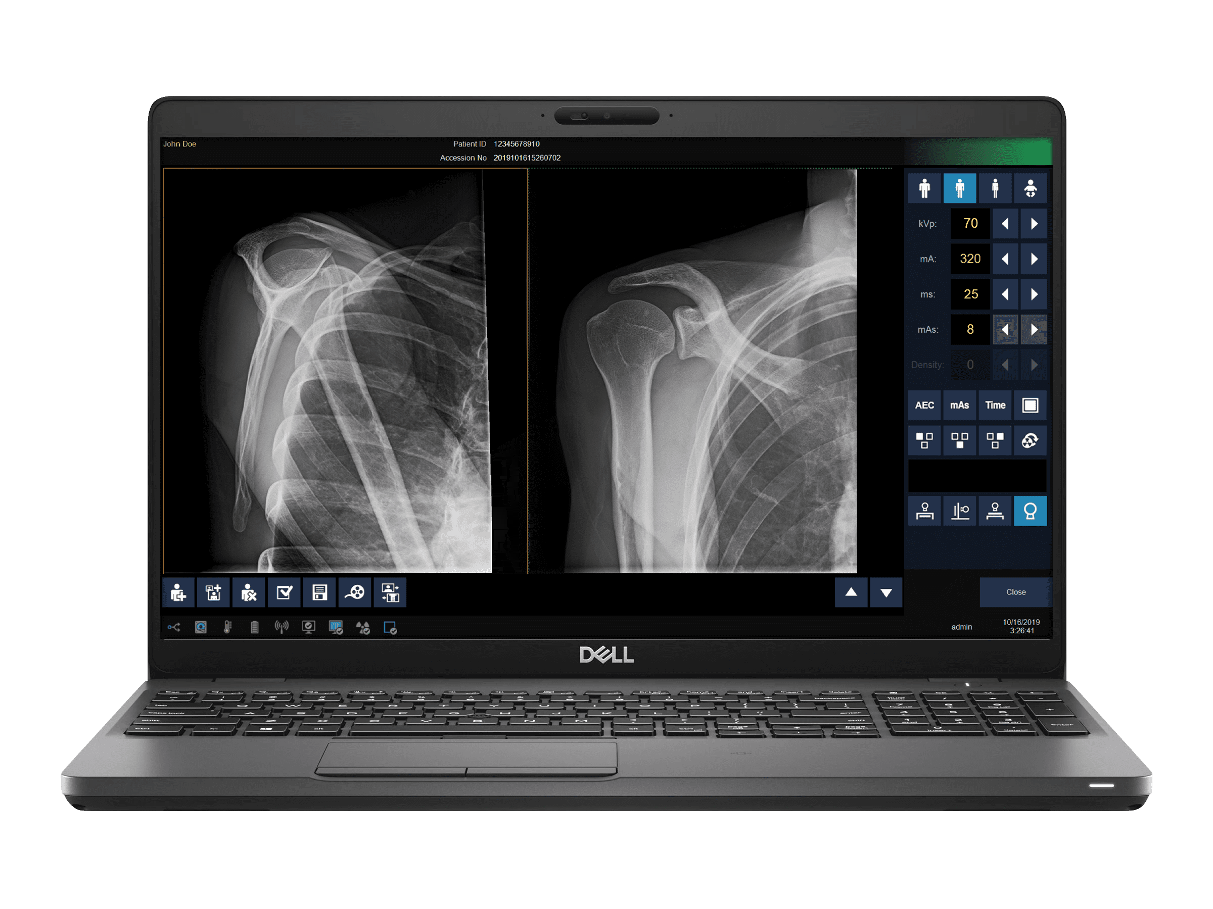 DELWORKS PICC Processing Tool
