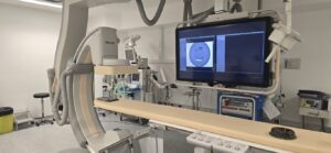 Philips Angio (Cath Lab) Allura XPER FD 20