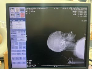 GE Optima 660 CT Scan