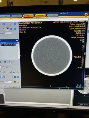 Philips CT Ingenuity Core CT Scan