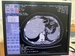 GE Optima 660 CT Scan