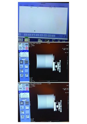 GE Optima 660 CT Scan