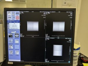 GE Revolution EVO CT Scan