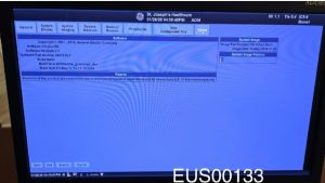 GE LOGIQ E9 XDclear Ultrasound