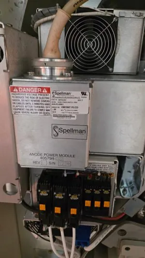 Philips Ingenuity CT Scan