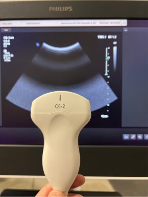 Philips Ultrasound Affiniti 70 W HWB Ultrasound
