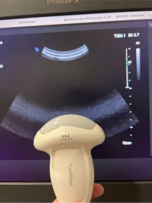 Philips Ultrasound Affiniti 70 W HWB Ultrasound