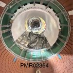 Philips body coil 1.5T MRI