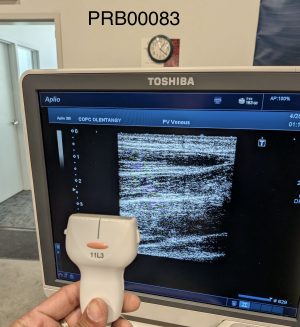 Toshiba PLT-705BT Linear Array Probe Probe