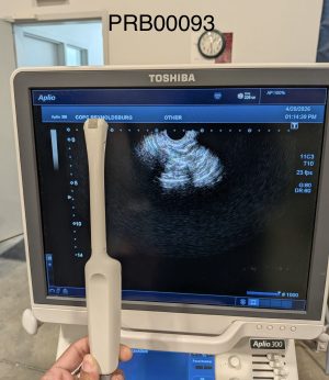 Canon PVT-781VT Endocavitary Probe Probe