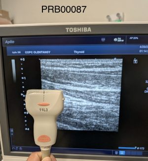 Canon PLT-705BT Linear Array Probe Probe