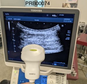 Toshiba PVT-382BT Convex Array Probe Probe