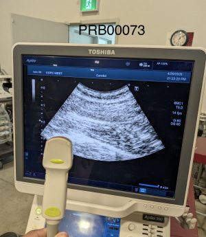 Toshiba PVT-375BT Convex Array Probe Probe