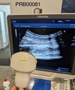 Toshiba PVT-375BT Convex Array Probe Probe