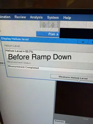 Philips Achieva 3.0T MRI