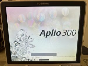 TOSHIBA APLIO 300 Ultrasound