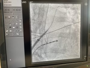 PHILIPS Allura Xper FD10 F Angio - C Arm