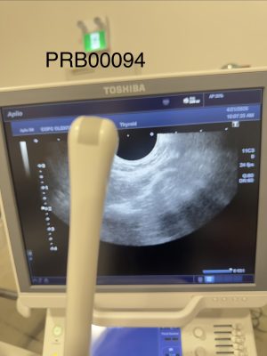 Toshiba PVT-781VTE Endocavitary Probe Probe