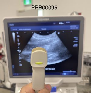 Toshiba PVT-382BT Convex Array Transducer Probe