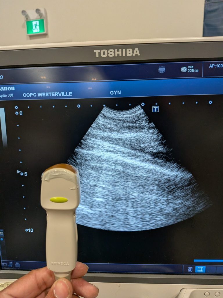 Canon Convex Array Transducer Probe 2015| Technomed Medical…
