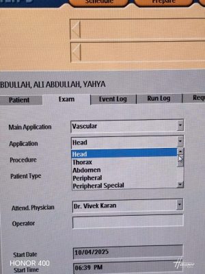Philips Allura Xper FD20 C Angio - C Arm