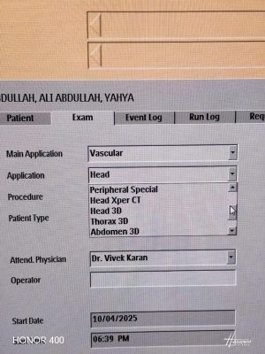 Philips Allura Xper FD20 C Angio - C Arm