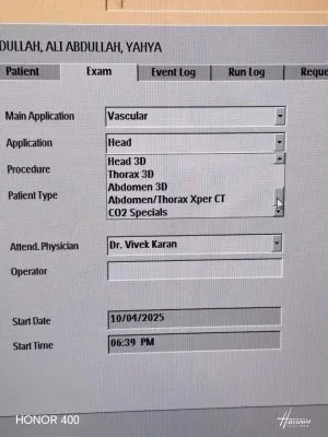 Philips Allura Xper FD20 C Angio - C Arm