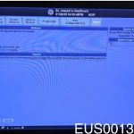GE LOGIQ E9 XDclear Ultrasound