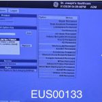 GE LOGIQ E9 XDclear Ultrasound