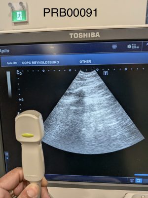 Toshiba PVT-382BT Convex Array Probe Probe