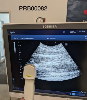 Toshiba PVT-382BT Convex Array Probe Probe