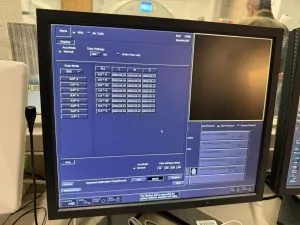 Aquilion ONE GENESIS Edition CT Scan