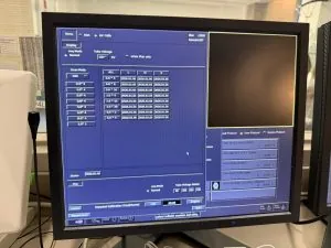 Aquilion ONE GENESIS Edition CT Scan
