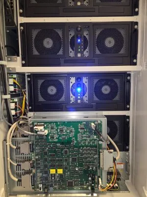 Aquilion ONE GENESIS Edition CT Scan