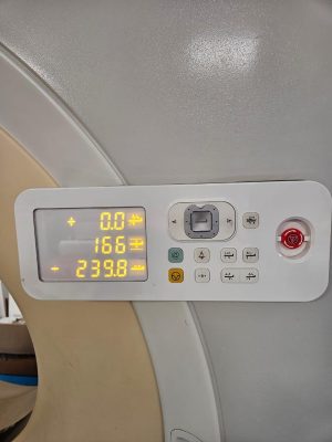 Philips CT Ingenuity 64-Slice CT Scan