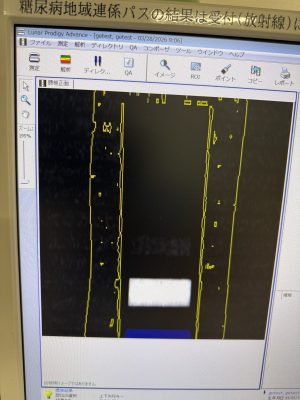 GE Lunar Prodigy Advance Bone Densitometry