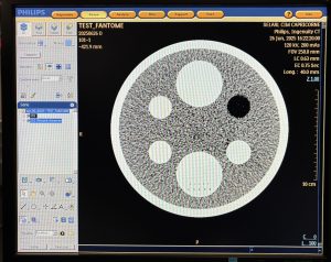 Philips CT Ingenuity 64-Slice CT Scan