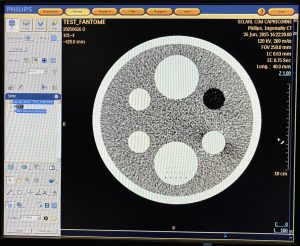 Philips CT Ingenuity 64-Slice CT Scan