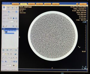 Philips CT Ingenuity 64-Slice CT Scan