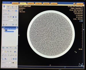 Philips CT Ingenuity 64-Slice CT Scan