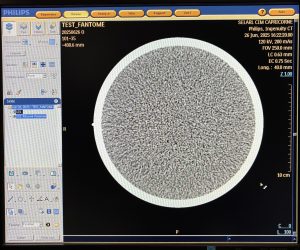 Philips CT Ingenuity 64-Slice CT Scan