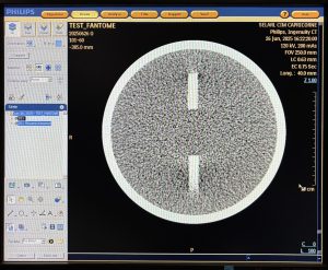 Philips CT Ingenuity 64-Slice CT Scan