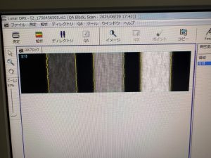 GE Lunar DPX Bravo Bone Densitometry