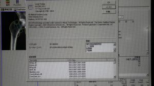 GE Lunar PRODIGY Bone Densitometry