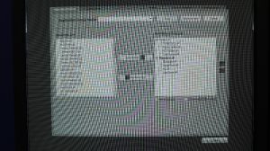 SIEMENS Cios Select Angio - C Arm