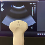 Philips Ultrasound Affiniti 70 W HWB Ultrasound