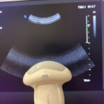Philips Ultrasound Affiniti 70 W HWB Ultrasound